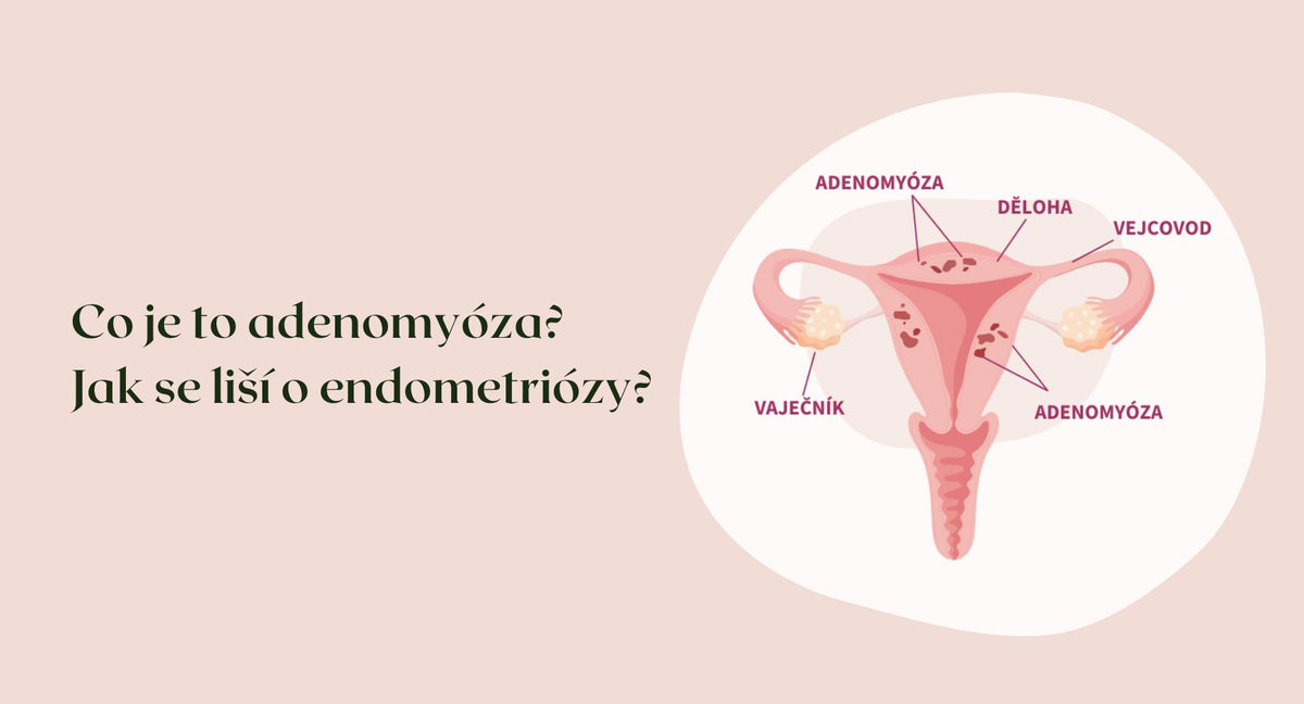Co je to Adenomyoza?
