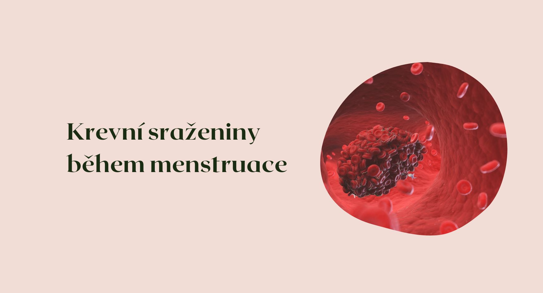 Krevní sraženiny během menstruace